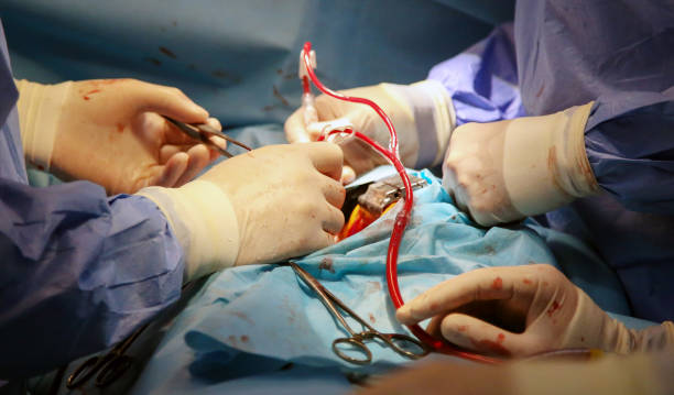 best coronary bypass surgery in thane